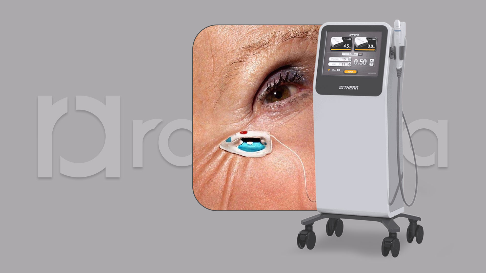 10THERA HIFU Rejuvenation machines