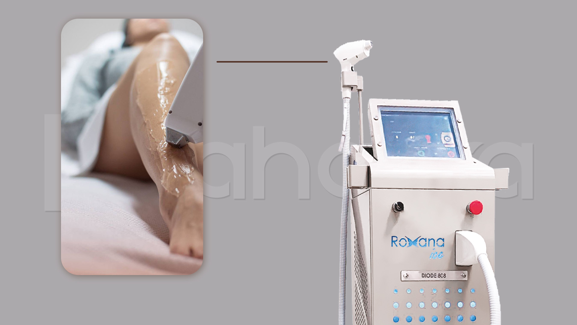 persian Laser Treatment 